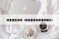 明星整形失败（明星整容失败案例图片）